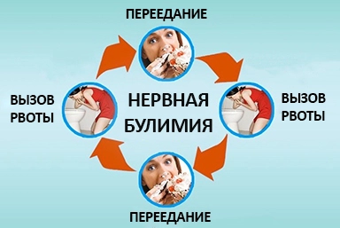 Лечение булимии в Жатае